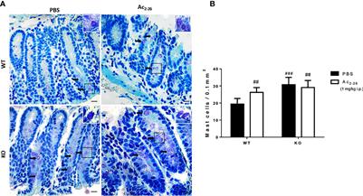 Annexin A1 Mimetic Peptide Ac2-26 Modulates the Function of Murine Colonic and Human Mast Cells